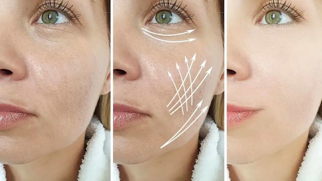 Can One Treatment Really Tackle More Than One Skin Concern Windlesham?