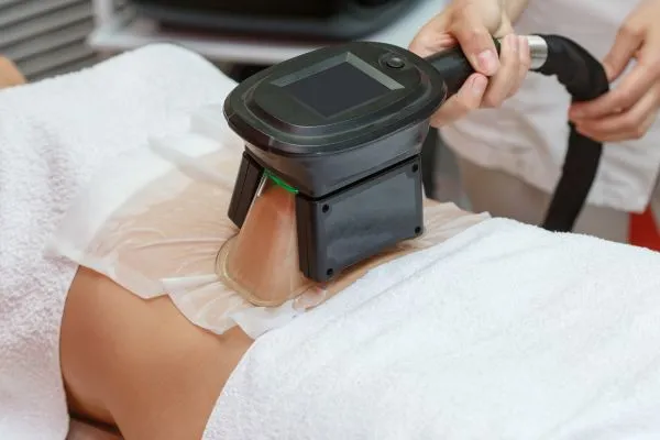 Image of person having fat freezing treatment to help weight gain Windlesham