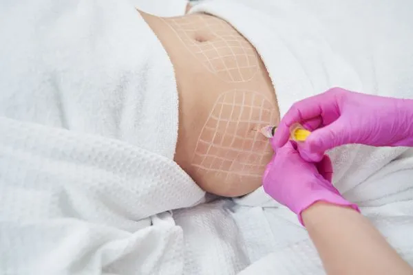 image of fat dissolving injections on love handles to help combat weight gain Windlesham