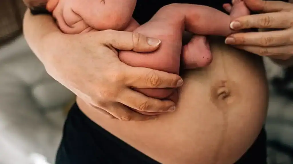 Why Is My Stomach Still Big After Pregnancy Windlesham?